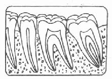 正常牙槽骨