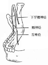 下牙槽神经、颊神经、舌神经位置示意图