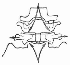 寰椎受力示意－冠状位